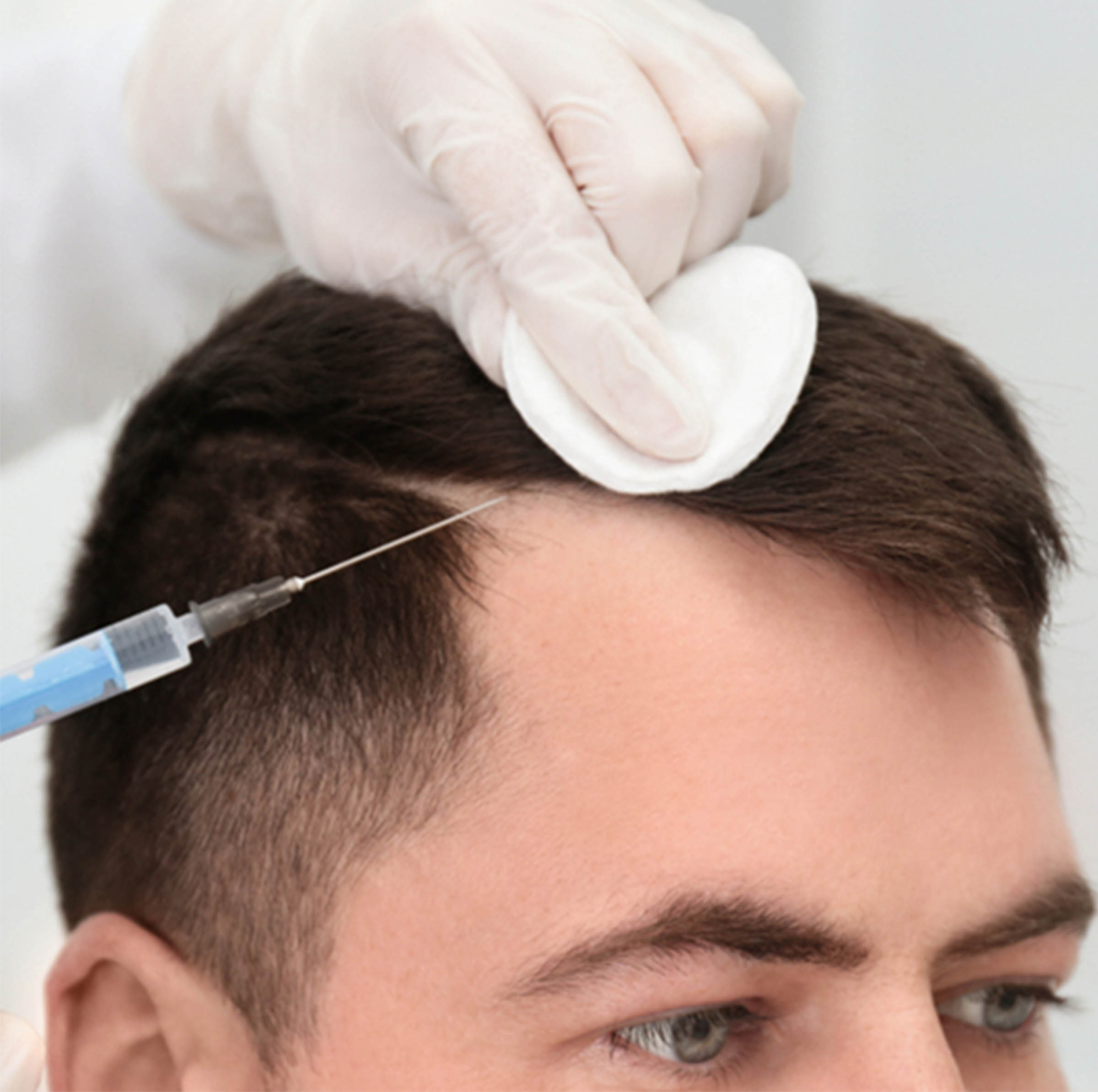 Stem Cell Hair Restoration Natural Hair Clinic Usa